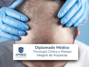 Tricologia_Clinica_Manejo_Integral_Alopecias.webp