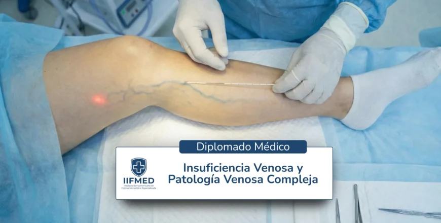 insuficiencia_venosa.webp