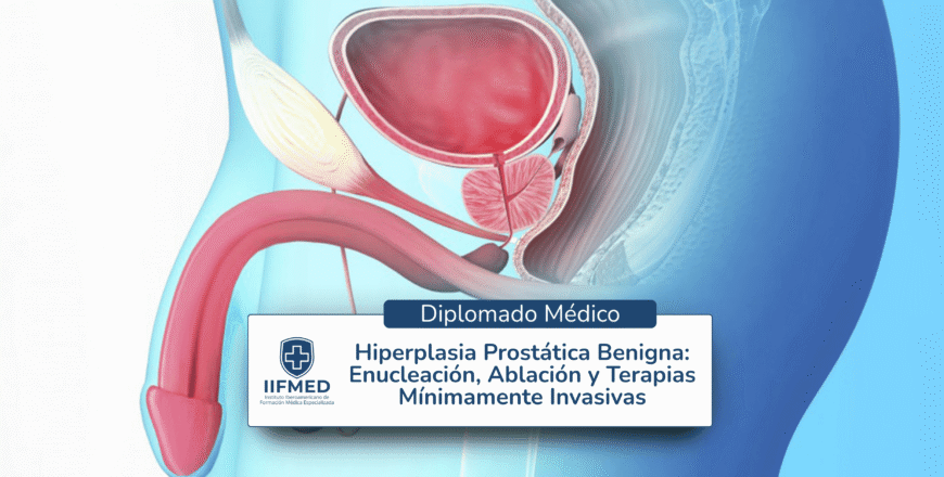 Diplomado en Hiperplasia Prostática Benigna Enucleación, Ablación y Terapias Mínimamente Invasivas.png