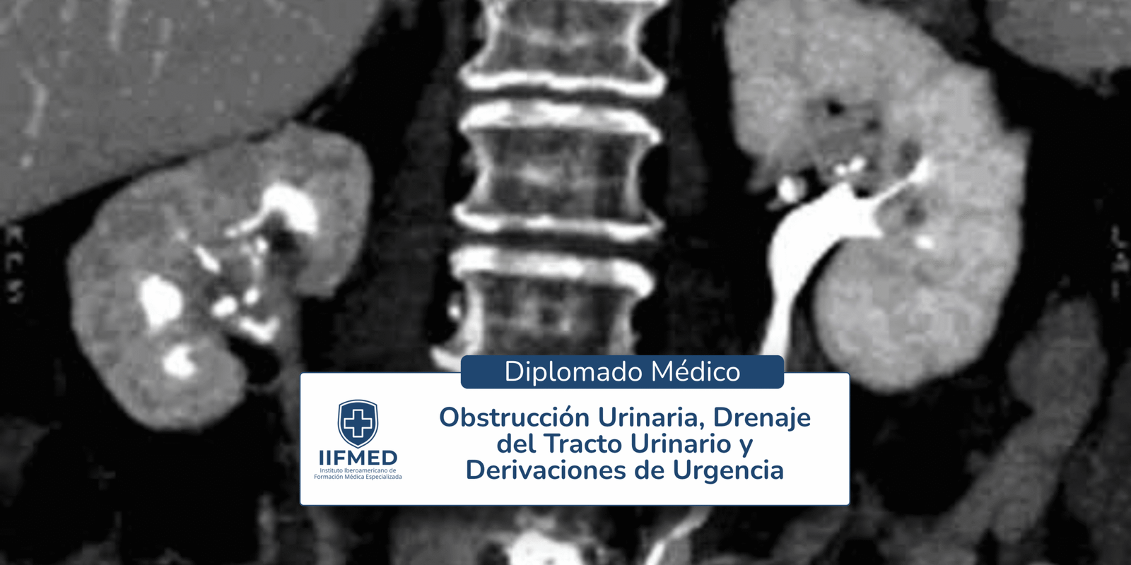 Diplomado en Obstrucción Urinaria, Drenaje del Tracto Urinario y Derivaciones de Urgencia